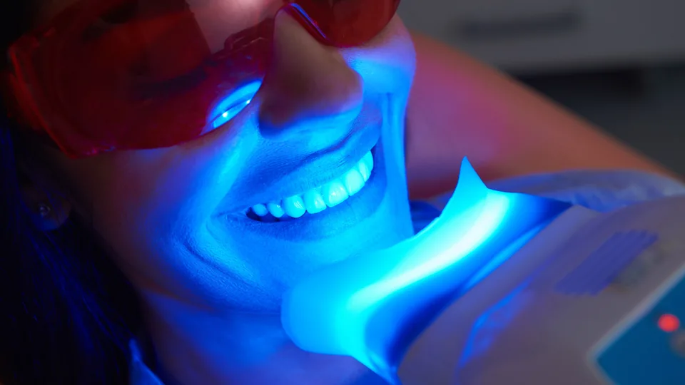 Procedimiento de blanqueamiento dental con luz y protección ocular
